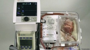 Realizan primer trasplante en Europa con corazón que no latía.