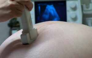 EEUU: más de 100 mujeres someten demanda por error en píldora anticonceptiva  