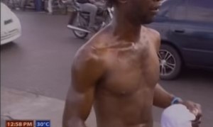 Hombre quema a otro con aceite por supuesta deuda de RD$1,400  