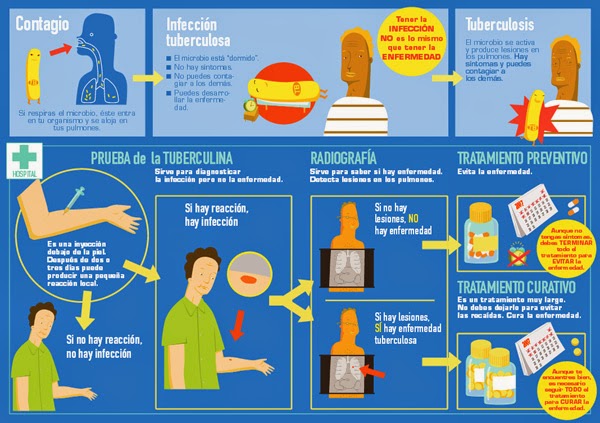 Hoy es el Día Mundial de la Tuberculosis 2016