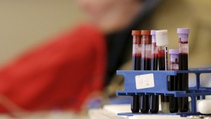 Bioquímico chileno crea un detergente capaz de proteger del zika