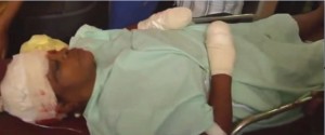 PN exhorta a entregarse hombre que mutiló manos a su pareja en Yamasá