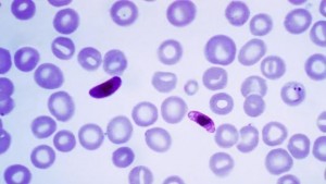 Revelan método para mejorar  tratamiento terapéutica contra la malaria cerebral