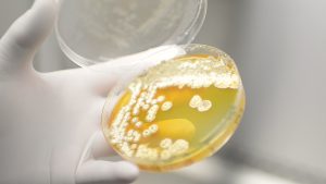 Descubren antibiótico en Costa Rica para atacar hongo que afecta a humanos