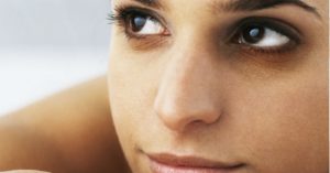 Remedios para eliminar las ojeras 