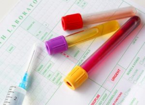 Leptospirosis