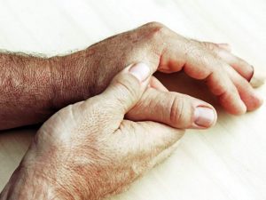 Se descubre fármaco para la diabetes retrasa la progresión del parkinson