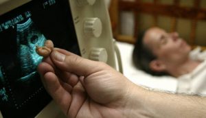Las mujeres centroamericanas se juegan la vida para abortar, según ONG