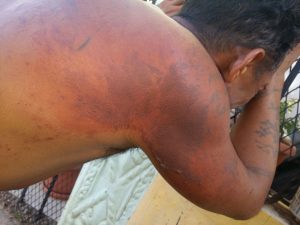 Hombre denuncia agente PN lo golpeó salvajemente por deuda