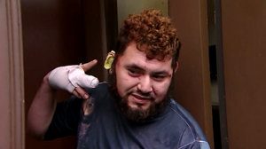Hombre arranca la oreja de una mordida a un mexicano tras discutir por Trump