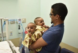 Médicos en NY separan a siamesas dominicanas dominicanas 