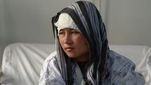 Zarina, una afgana mutilada por su marido suplica ayuda al mundo