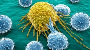 Identifican un gen esencial en la resistencia de un cáncer de mama agresivo
