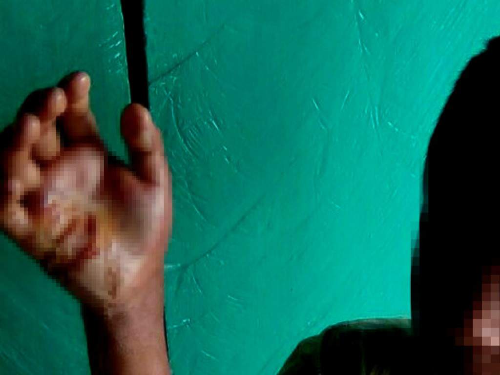 Madre quema mano de hijo porque le robó dinero