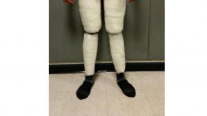 Arrestan dominicano en el  aeropuerto JFK de Nueva York por “enyesarse” las piernas con Cocina 