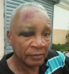 Delincuentes atacan a golpes presidente Asociación de Boxeo El Seibo