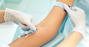Investigadores de EEUU desarrollan rápida prueba sanguínea para tuberculosis