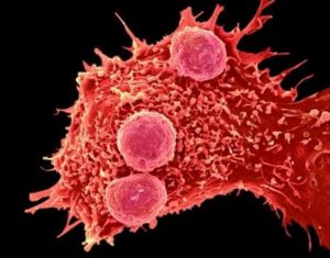 China inicia su primer ensayo clínico en humanos de la historia del sistema de edición genómica CRISPR.