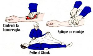 Las más inofensivas cosas que usamos o hacemos cotidianamente pueden causarnos problemas inesperados.