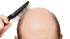 Expertos crean nuevo tratamiento para la calvicie y además el control de la aparición de canas.