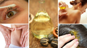 Beneficios del aceite de ricino