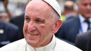El papa Francisco se golpea el rostro en el papamóvil