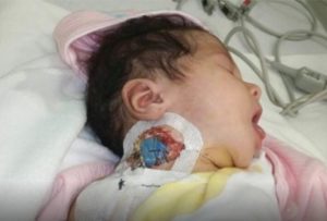 Realizarán de emergencia primera cirugía a niña Astrid Montero en Boston este lunes 