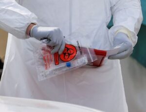 EE.UU. aprueba el primer test de COVID-19 para autodiagnóstico casero