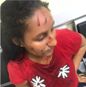 Joven denuncia fue agredida por tres mujeres 