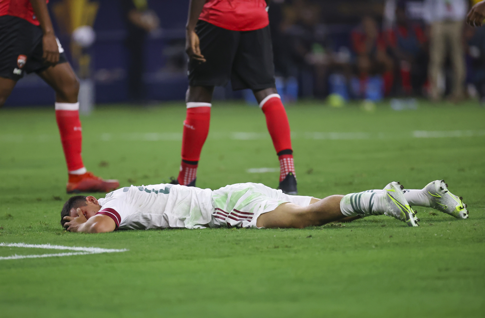 Hirving Lozano tuvo que salir del campo en el inicio de juego por golpe en el ojo izquierdo sufrido tras estrellarse con rodilla del portero Marvin Phillip.