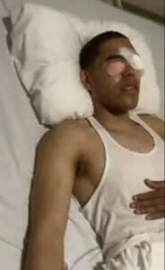 Cabo de la Policía pierde un ojo durante protesta en Bonao