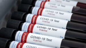 Nivel de anticuerpos varía en hombres y mujeres tras COVID, según estudio