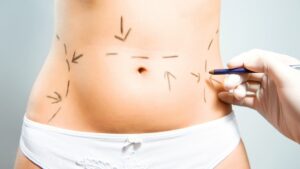 La narcoestética está cambiando el cuerpo de las mujeres sinaloenses