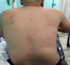 Un raso de la Policía y un civil resultaron heridos la noche de este sábado cuando una patrulla fue recibida con tiros, piedras y botellazos