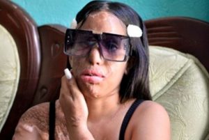 Concluye presentación contra implicados en agresión a Yocairi Amarante