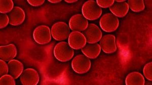 La Leucemia Linfocítica Crónica afecta a personas de avanzada edad