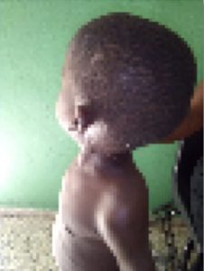 Una mujer de nacionalidad haitiana quemó a sus dos hijos menores de edad con plástico ardiendo, en un hecho registrado en Sabana Grande de Boyá