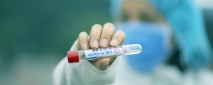 Coronavirus: Salud Pública reporta 311 nuevos casos sin muertes