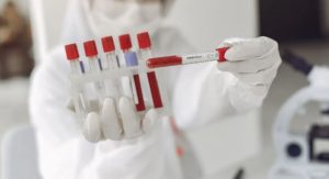 Capitaleños abarrotan laboratorios en busca de pruebas de Covid-19 
