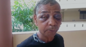 Desconocidos golpean salvajemente a 