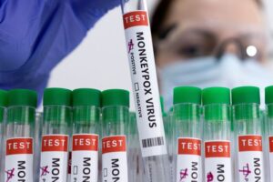 EEUU tiene un caso confirmado y cuatro sospechosos de viruela del mono