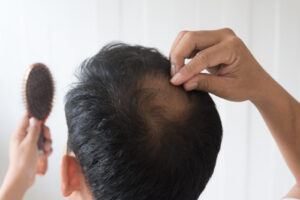 Descubren molécula que recupera el crecimiento del cabello
