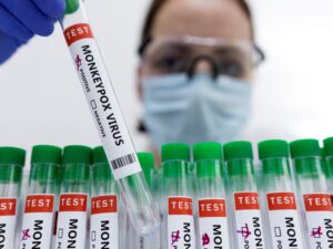 OMS se reunirá para decidir si declara emergencia internacional por viruela del mono